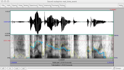 Voice visualization